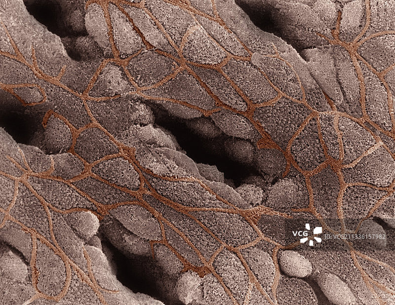 胃底胃小凹扫描电镜图片素材