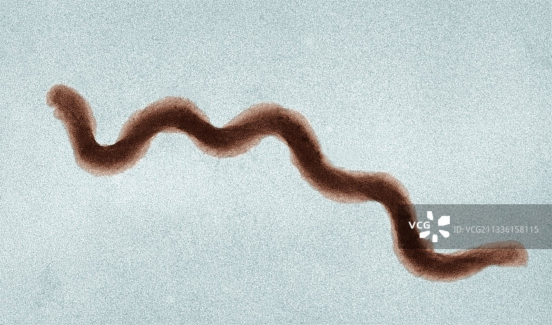 螺旋体细菌扫描电镜图像图片素材