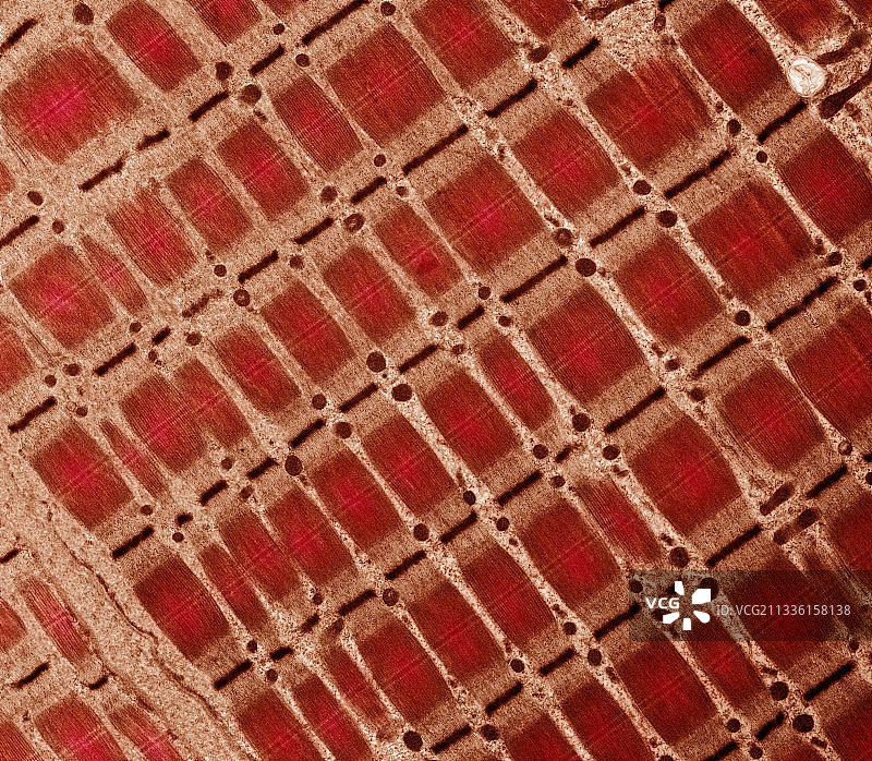 人的骨骼肌TEM图片素材