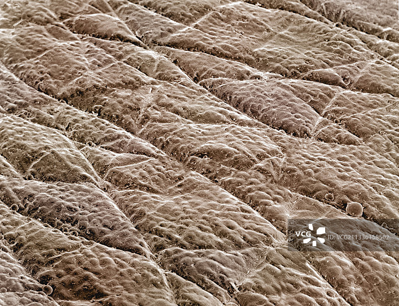 人体手部皮肤表面扫描电镜图图片素材