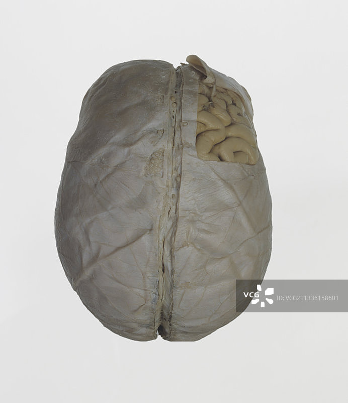 完整人脑，脑膜内图片素材