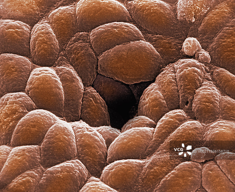 胃小凹开口扫描电镜图图片素材