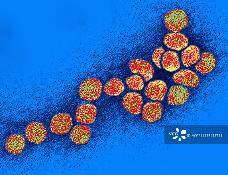 西尼罗河病毒，一种黄病毒图片素材