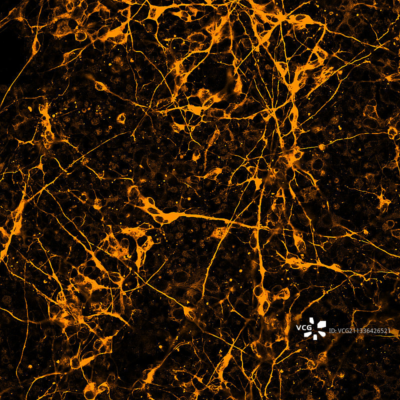 染色后的神经元图片素材