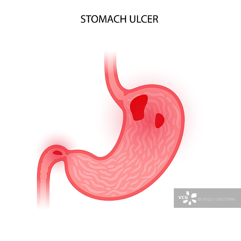 胃部标志概念图片素材