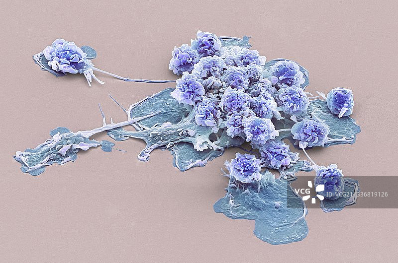 活化颗粒白细胞，扫描电镜图片素材