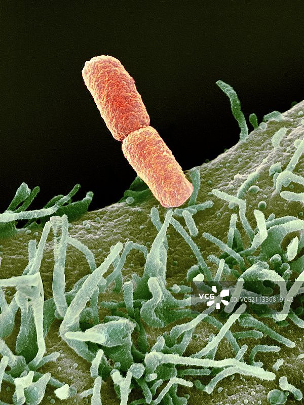 志贺氏菌细菌（扫描电镜图像）图片素材
