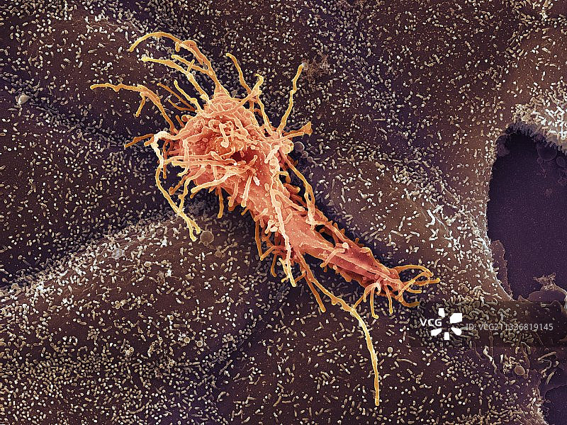 HeLa细胞扫描电镜图图片素材