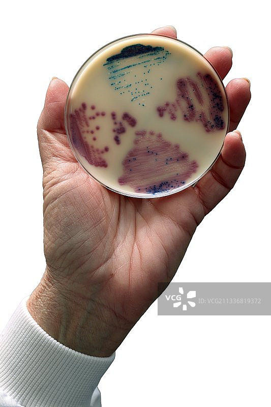 大肠杆菌和肠球菌培养图片素材