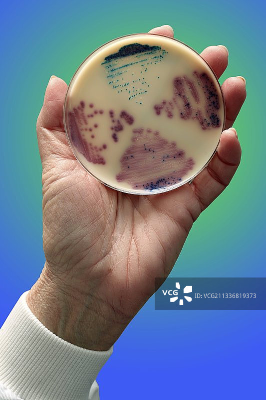大肠杆菌和肠球菌培养图片素材