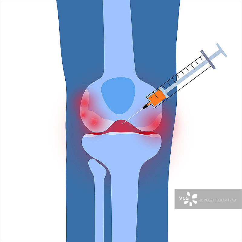 膝盖注射概念图片素材