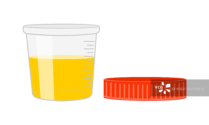 尿液分析尿液样本，完全打开的塑料图片素材
