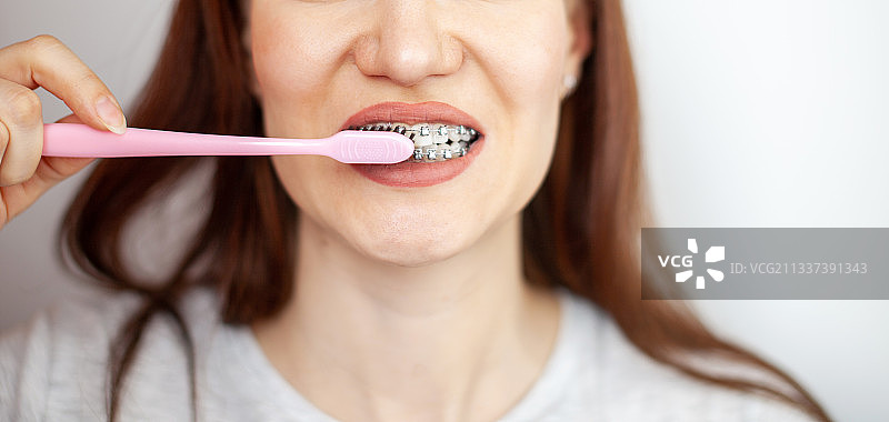 戴着牙套、拿着牙刷的女孩，露出洁白的牙齿图片素材