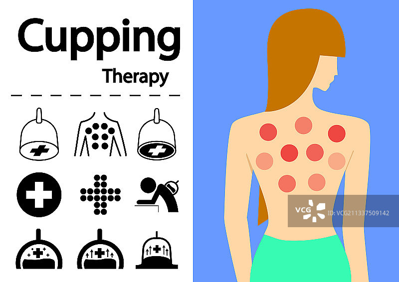 拔罐疗法扁平艺术图标图片素材