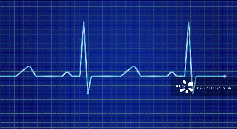 心电图示波器蓝屏图片素材