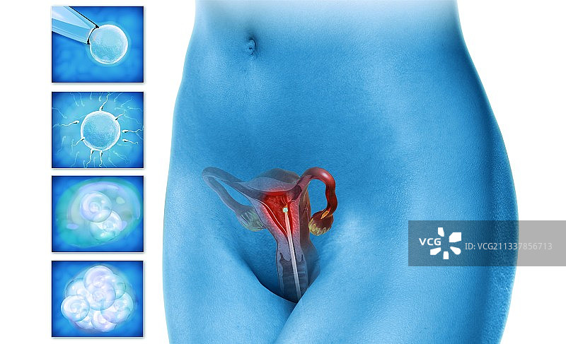 人工授精艺术作品图片素材