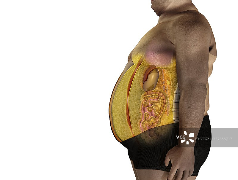 内脏脂肪医学插画图片素材