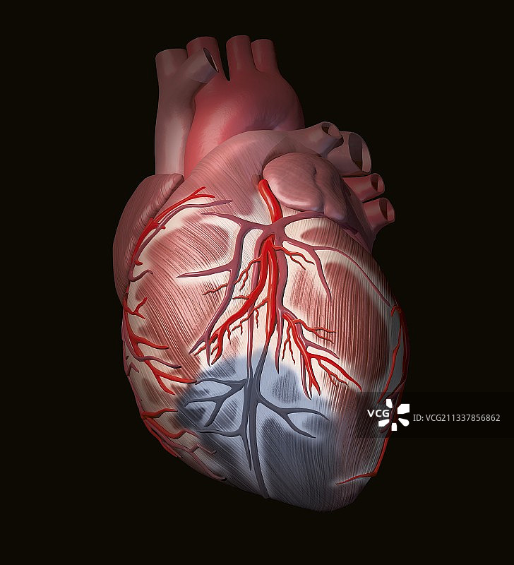 心脏病发作艺术图图片素材