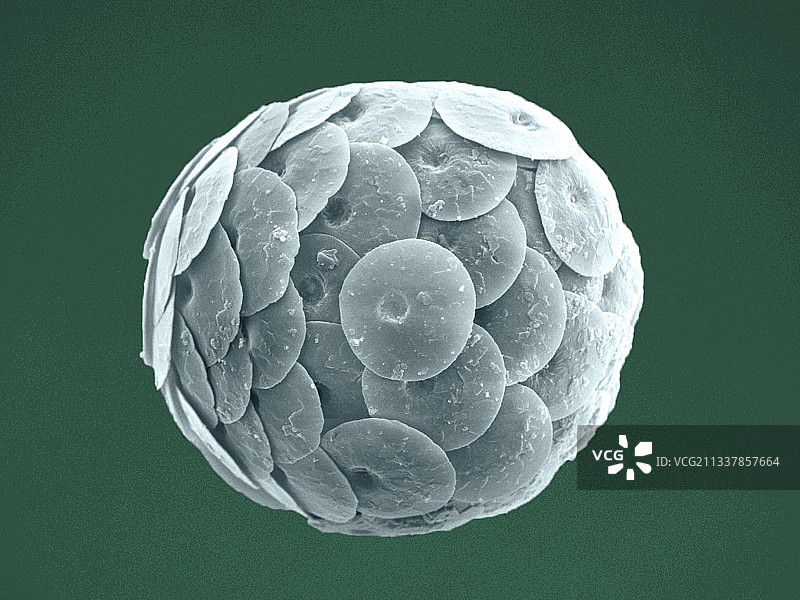 球石藻外壳扫描电镜图图片素材