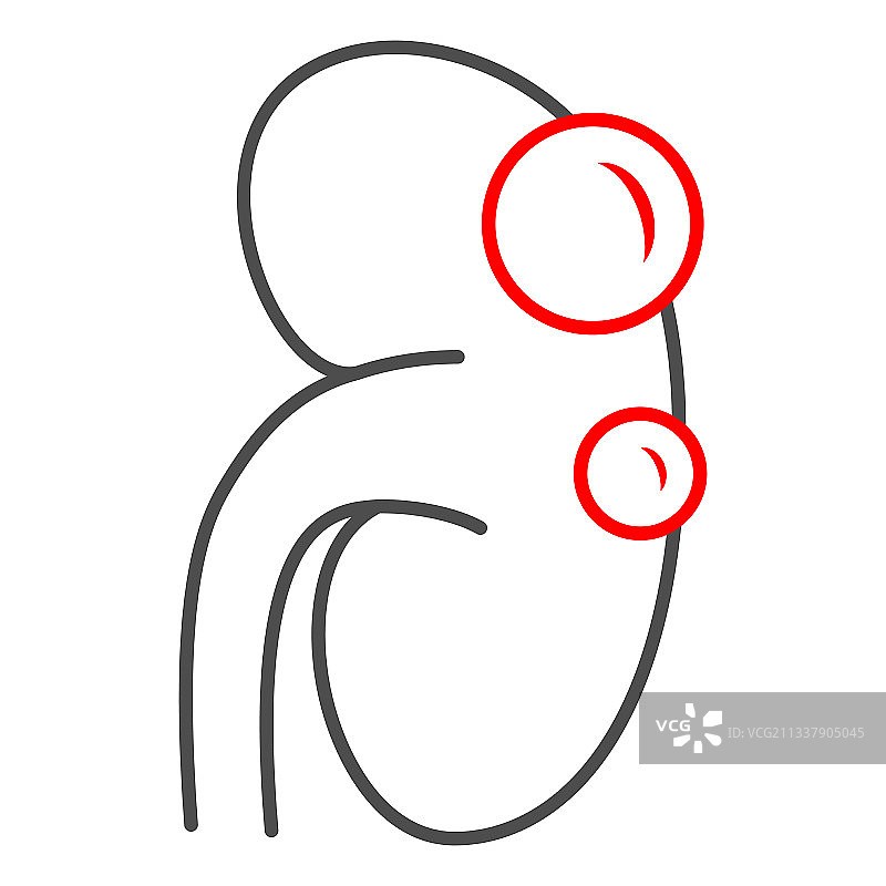 肾囊肿细线图标，人类疾病概念图片素材