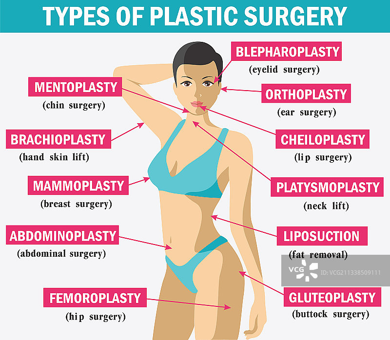 整形外科信息图图片素材