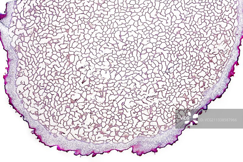 地星孢菌显微照片图片素材