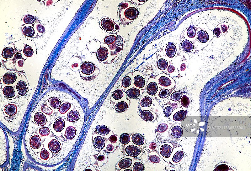 绦虫囊肿，光学显微照片图片素材