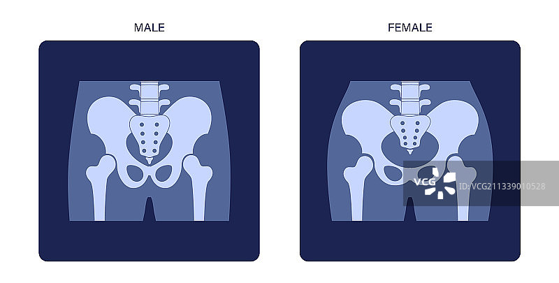 骨盆X光片图片素材