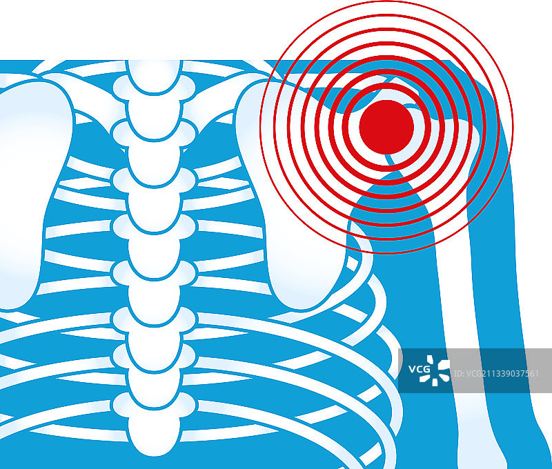 肩部风湿疼痛图片素材