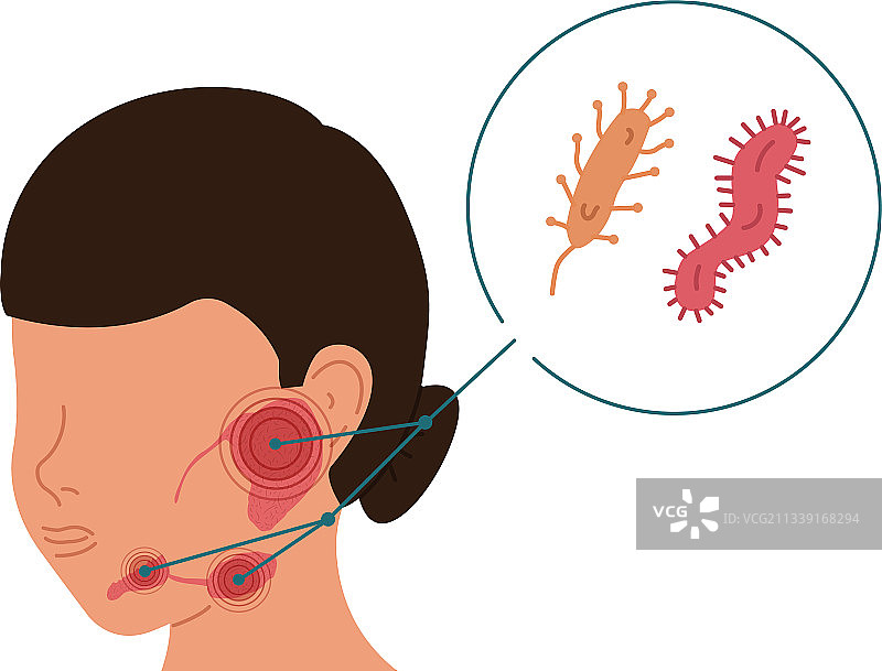患有细菌性炎症的女人图片素材