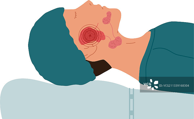 患有腮腺疾病的病人图片素材