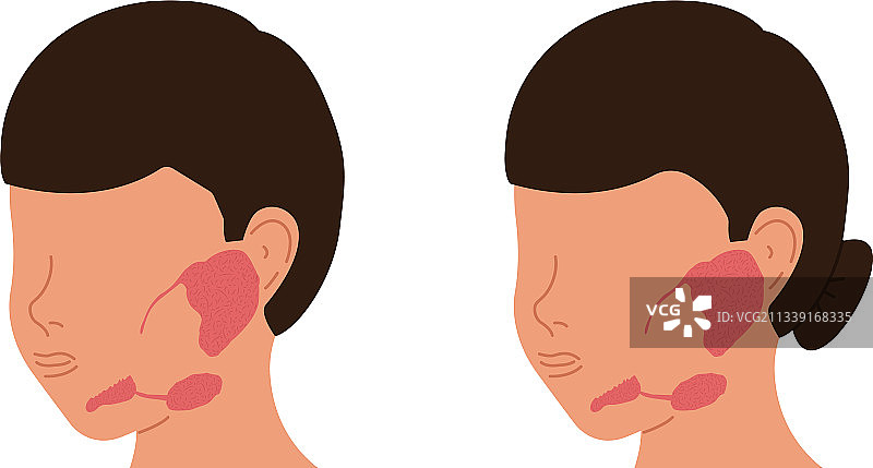 男性定位唾液腺图片素材