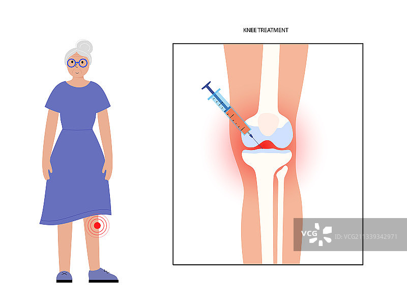 膝盖注射概念图片素材