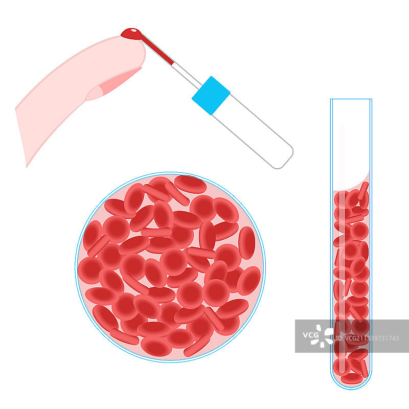 手指取血化验图片素材