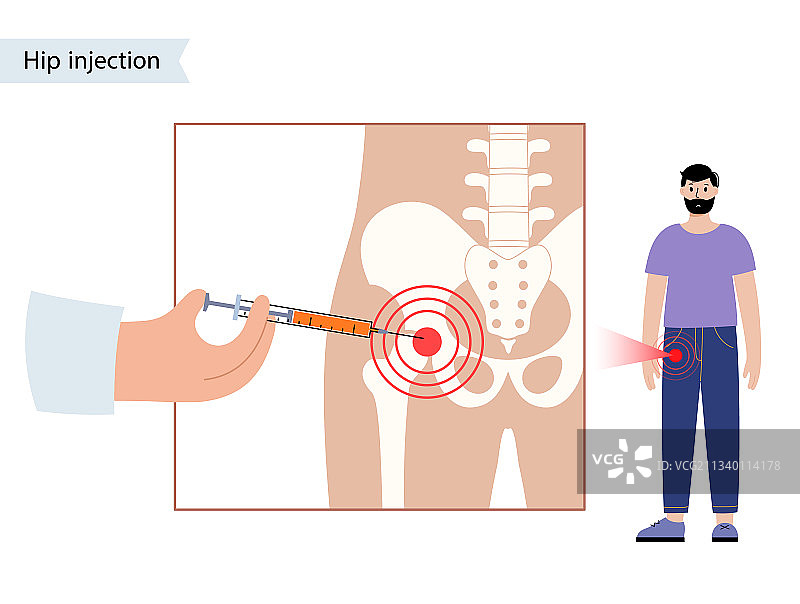 髋关节注射图片素材
