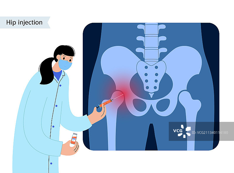 髋关节注射图片素材