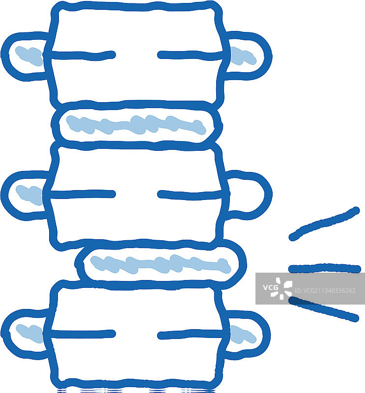 脊柱圆盘问题疼痛图片素材