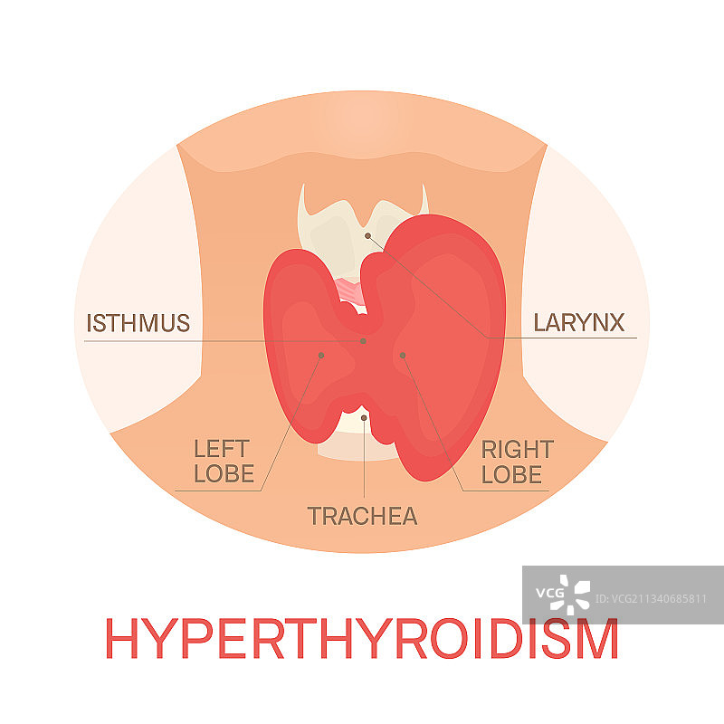 女性轮廓中的甲状腺图片素材