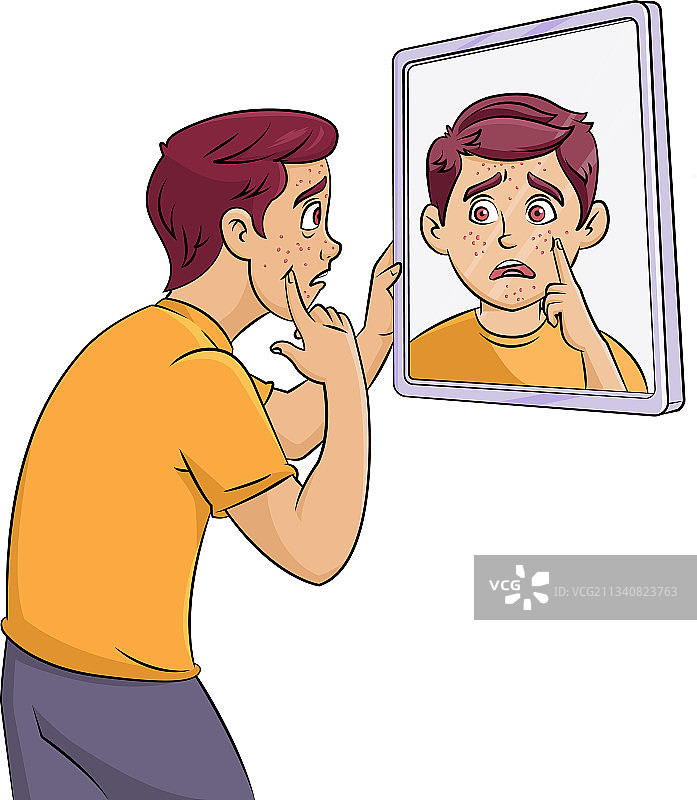 长有粉刺的青少年男孩图片素材