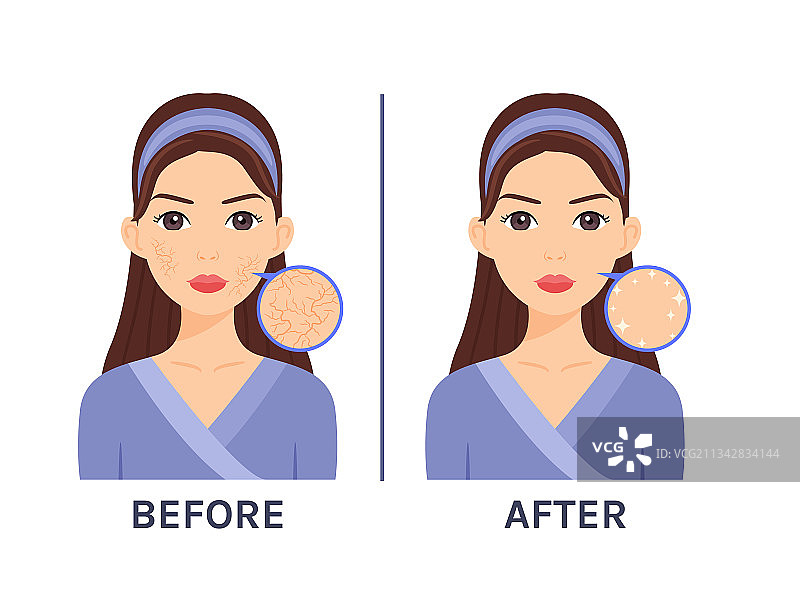 皮肤干燥女孩护理前后对比图片素材
