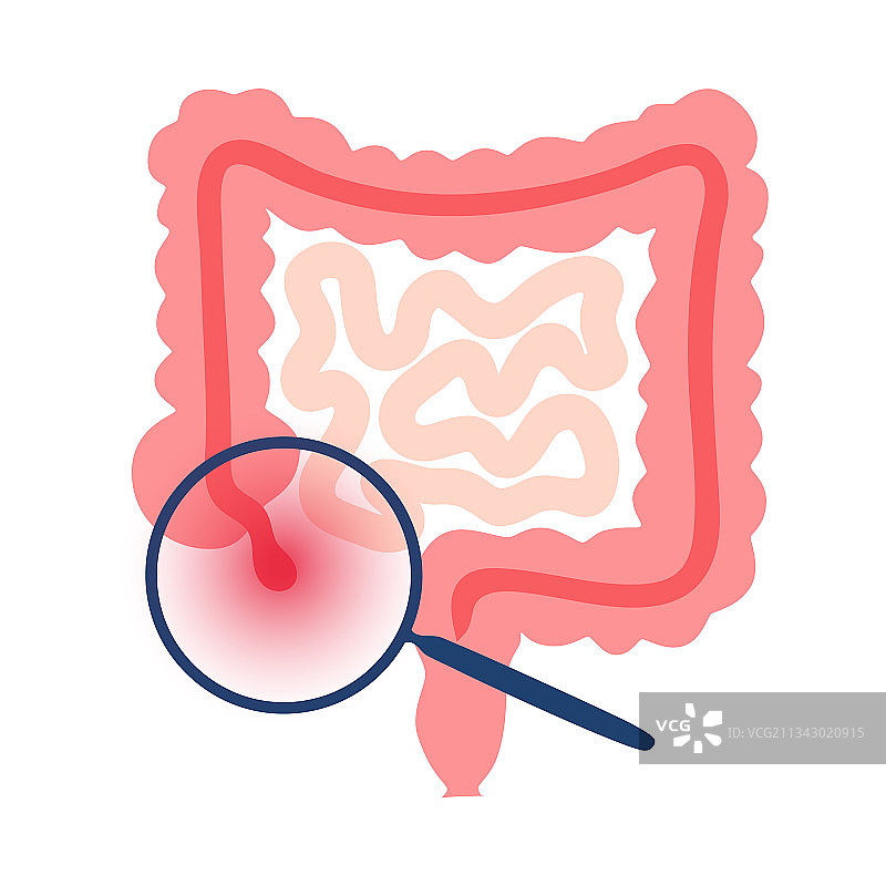 阑尾疼痛概念图片素材