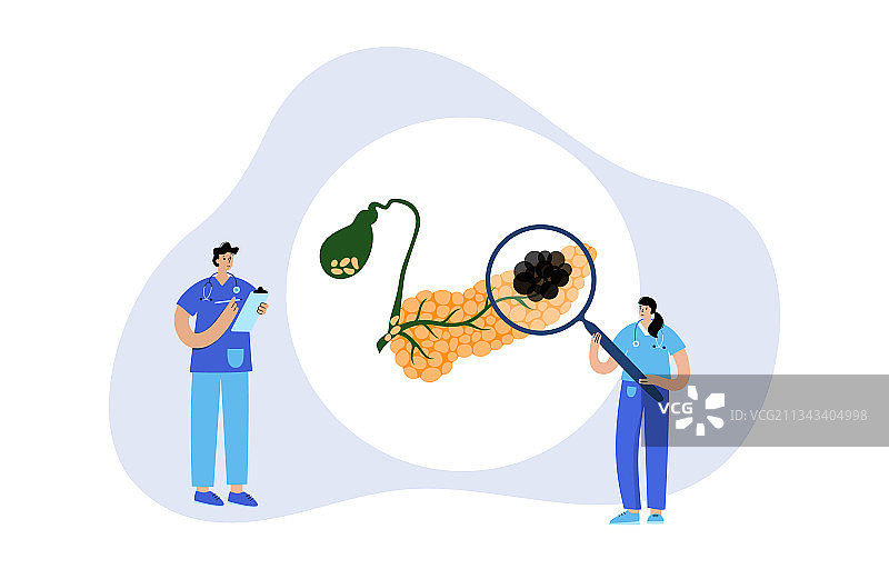 胰腺疾病与癌症图片素材