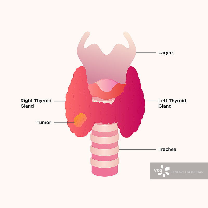 甲状腺和喉部图图片素材