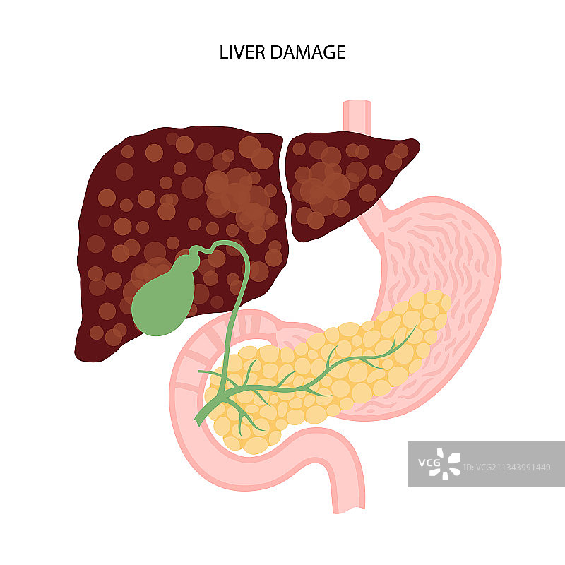 肝脏疾病概念图片素材