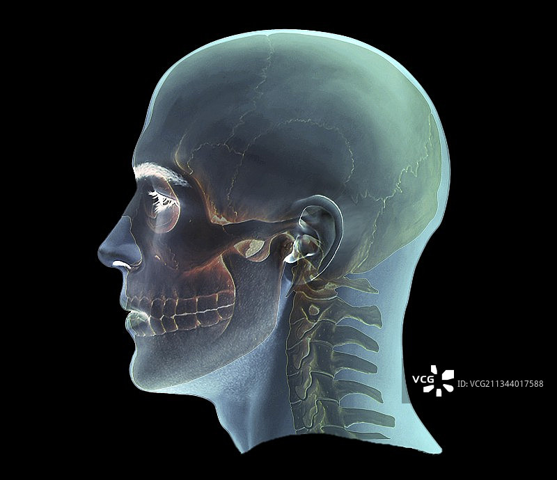人头3D CT扫描图片素材