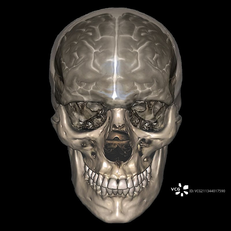 人头部的MRI和3D CT扫描图片素材