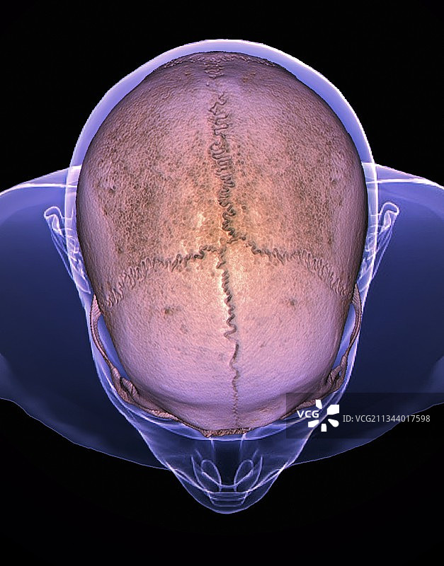 头骨缝合线3D CT扫描图片素材