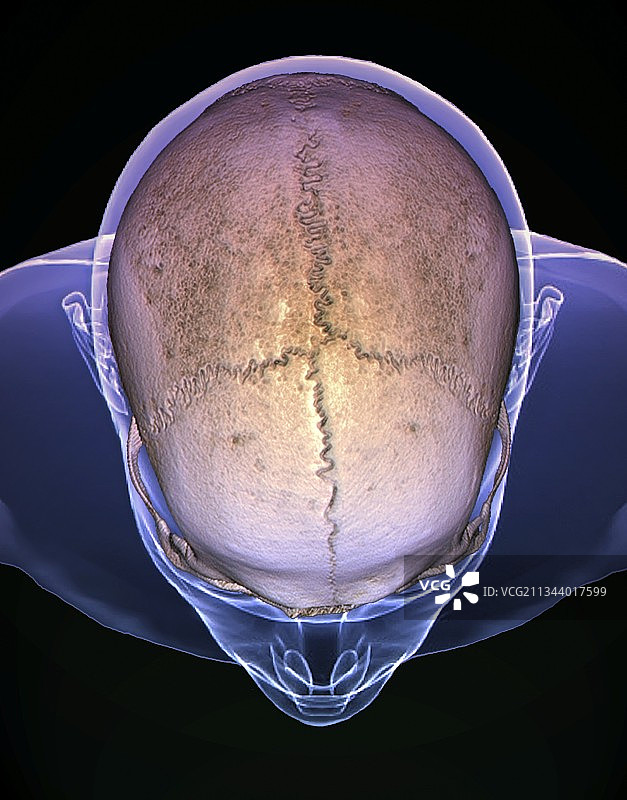 头骨缝合线3D CT扫描图片素材