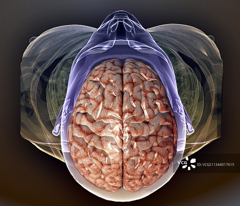人头部的MRI和3D CT扫描图片素材