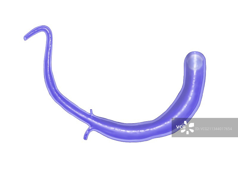 二尖瓣环成形术，艺术作品图片素材